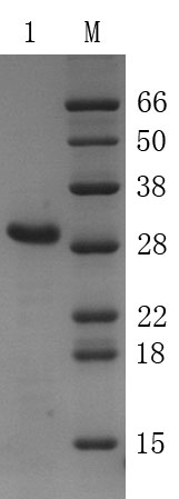Recombinant Bovine Enterokinase